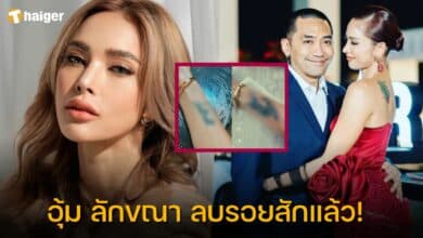 อุ้ม ลักขณา ลบรอยสัก ใช้นามสกุลเดิม