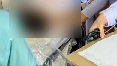 เด็ก 4 ขวบ ช็อค เลือดออกปาก