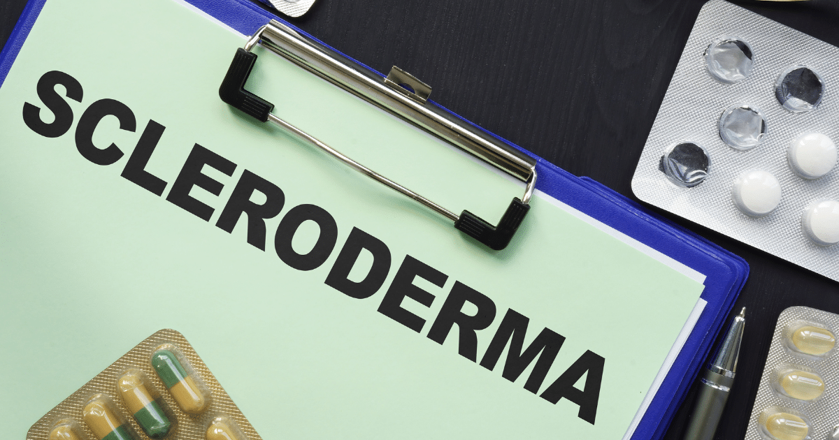 โรคผิวหนังแข็งอาการ