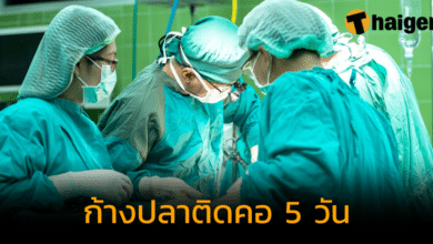 แพทย์เตือนให้ระวัง ก้างปลาติดคอ 5 วัน ส่องกล้องไม่เห็น ต้องอัลตราซาวน์แทน