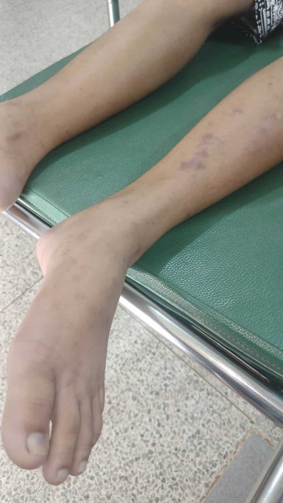 นักเรียนเสียชีวิต สอบพละ 2566