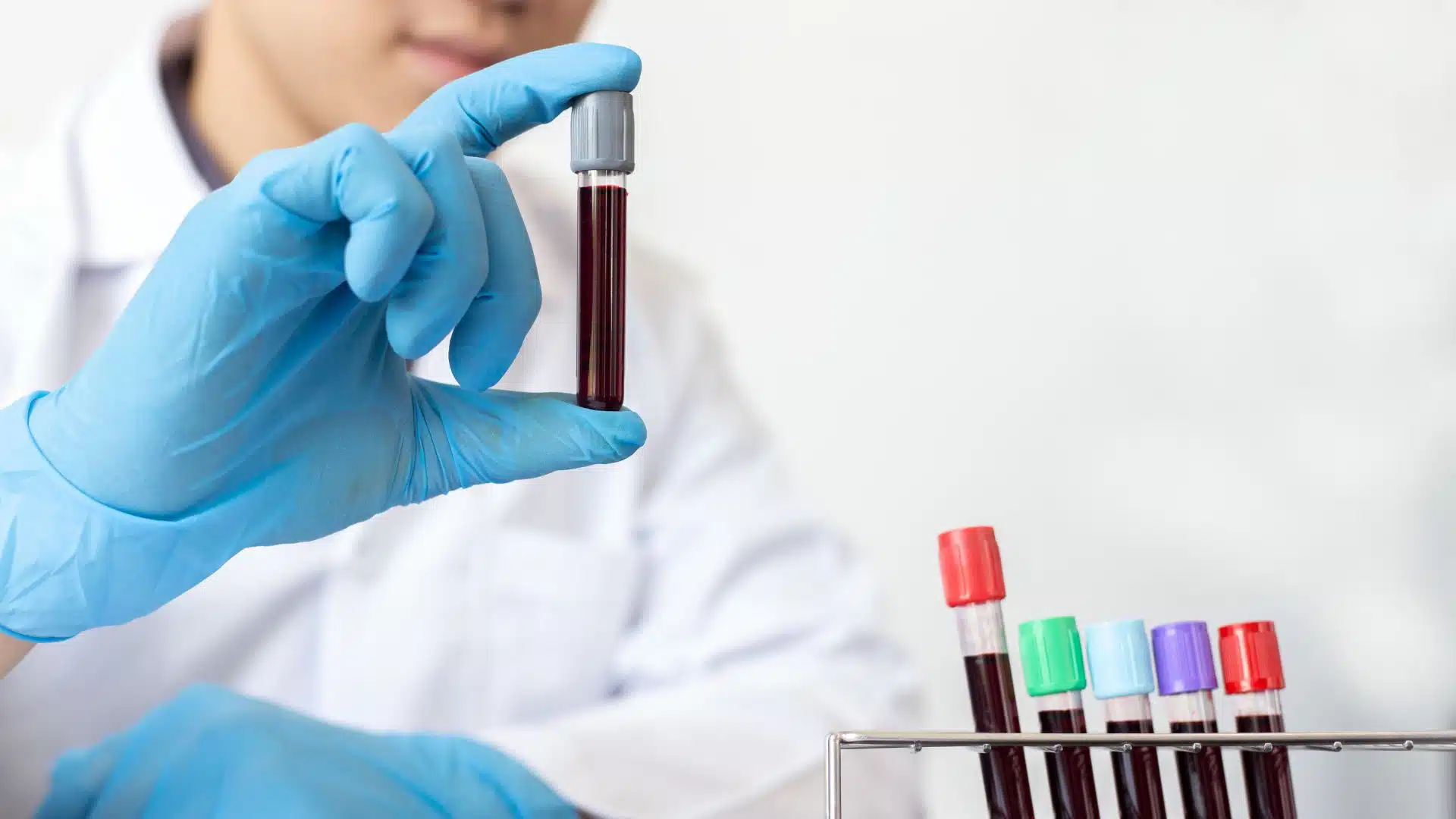 วิธีรักษา เลือดข้น