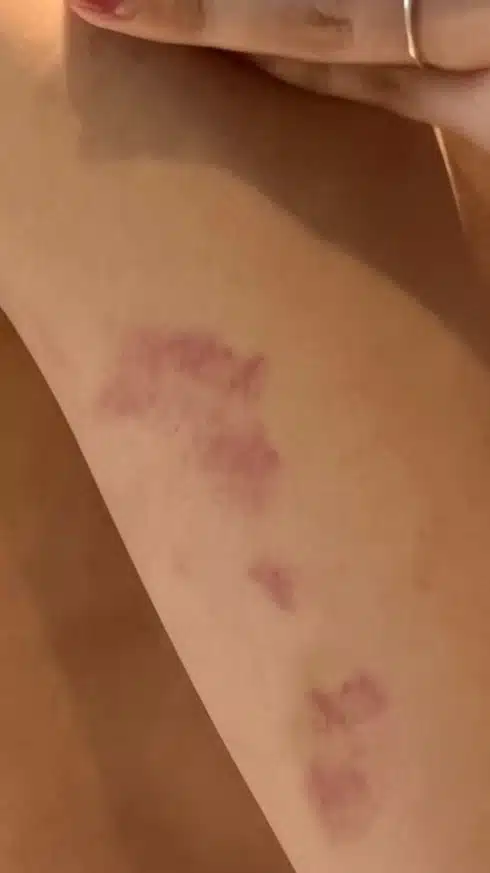 อดีตแฟนสาวแฉ เด็กฝึกค่ายดัง ทำร้ายร่างกาย