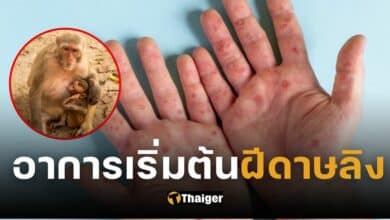 ปกฝีดาษลิง