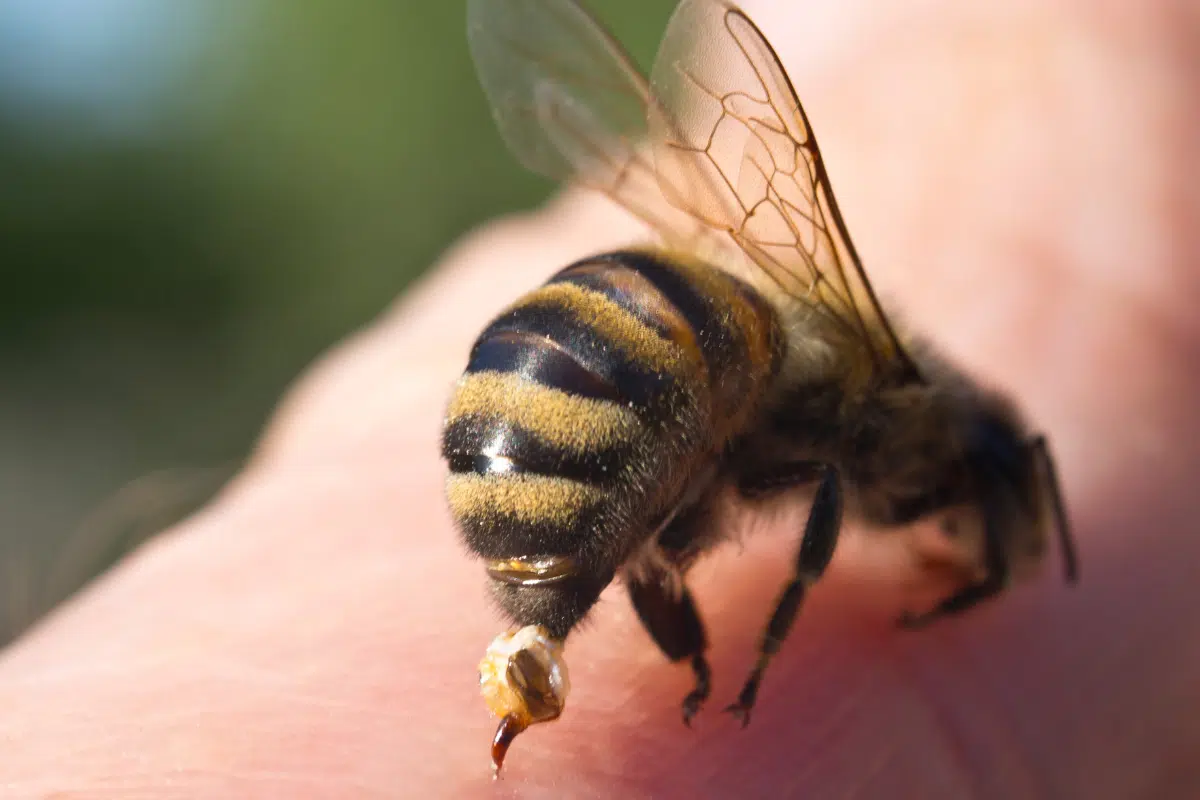 ฝันว่าโดนผึ้งต่อย ทำนายฝันเจ็บจี๊ด พร้อมตีเลขเด็ดนำโชค