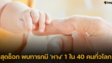 สุดช็อก พบทารกมี 'หาง' 1 ใน 40 คนทั่วโลก