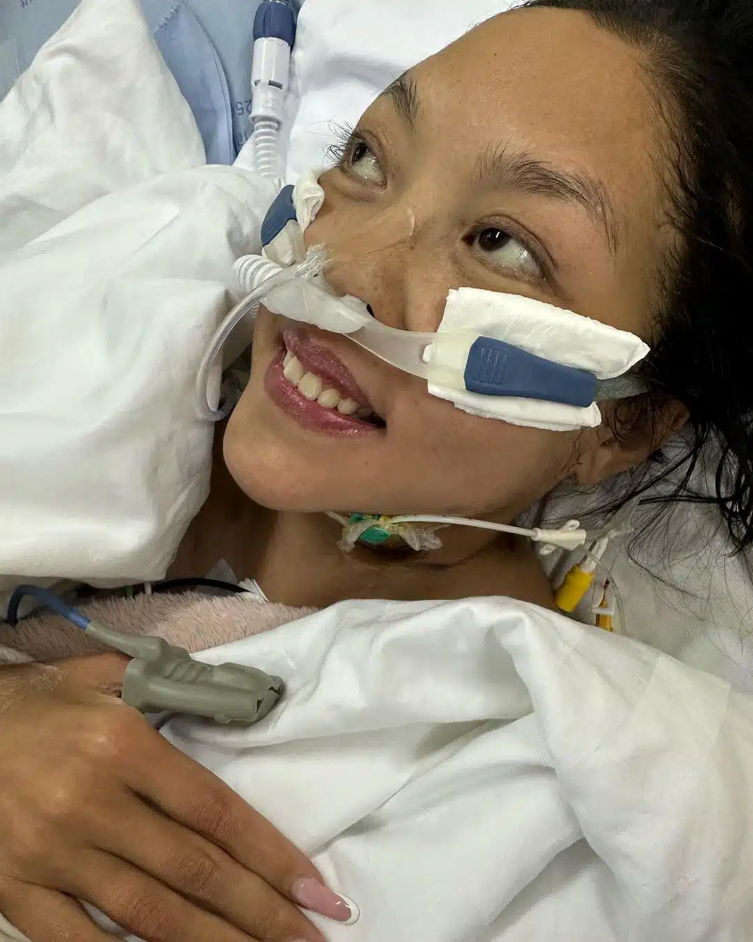 คุณหญิงแมงมุม ถอดเครื่องช่วยหายใจ