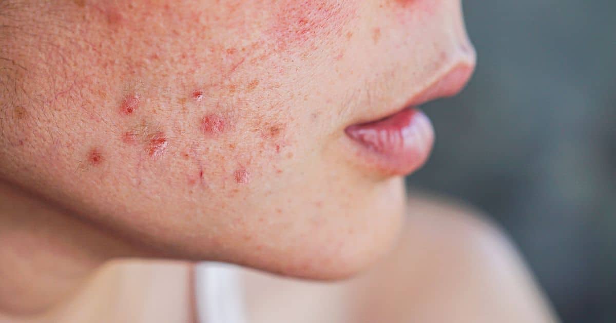 ทานซิงค์อย่างไรให้เห็นผล