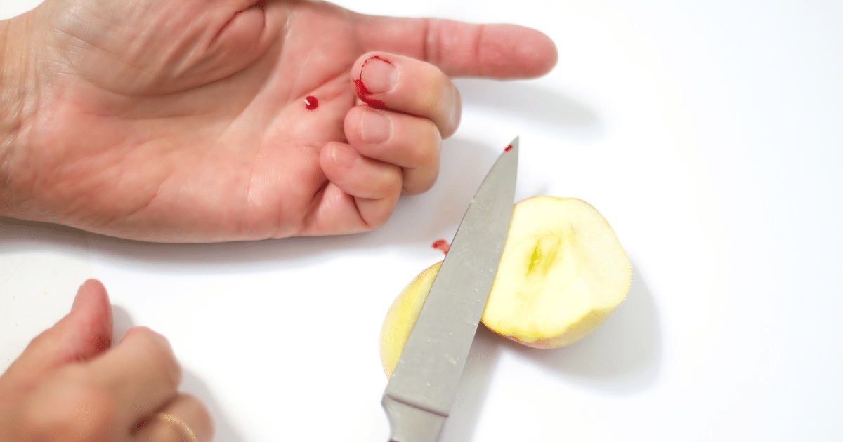 ฝันว่าเกิดอุบัติเหตุมีดบาดมือ