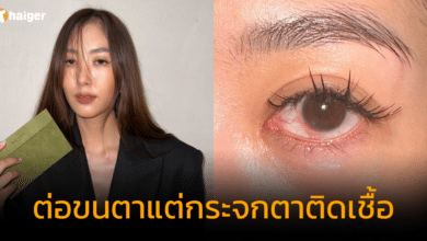 ยิปโซ ต่อขนตาแต่กระจกตาติดเชื้อ