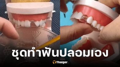 หมอฟันเตือนอย่าหลงซื้อ เจลซ่อมฟัน เสี่ยงติดเชื้อช่องปาก หลังฮิตในหมู่คนสูงอายุ