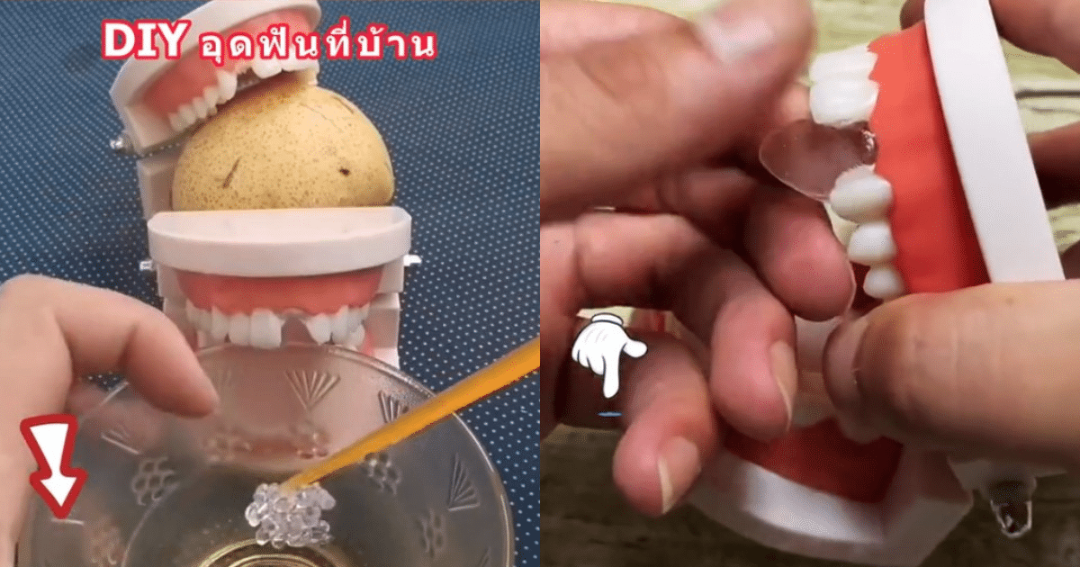หมอเตือน อย่าเชื่อทำฟันปลอมเอง
