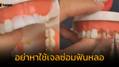 เจลซ่อมฟัน เสี่ยงเกิดปัญหาช่องปากเพียบ