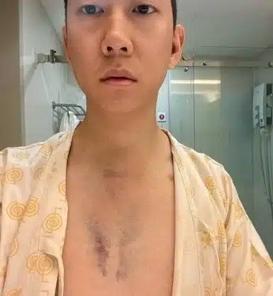 เบนซ์ เรซซิ่ง ป่วยเข้าโรงพยาบาล