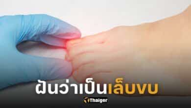 ปกฝันว่าเป็นเล็บขบ