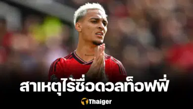 อันโตนี่ แมนยู