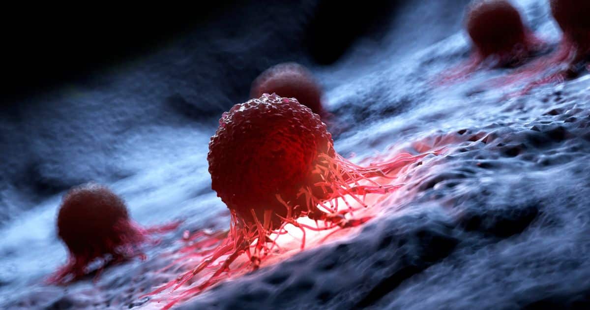 ผู้ประกันตน ม.33-ม.39 รักษามะเร็งฟรี