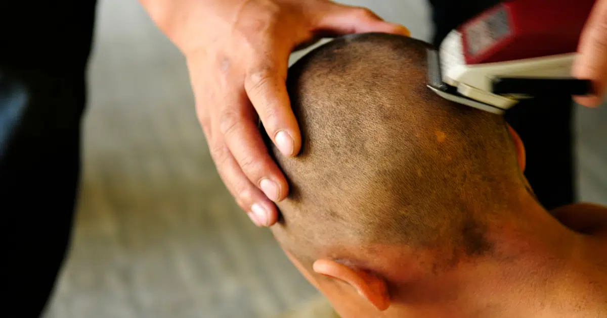 ฝันว่าถูกโกนหัวทรงสกินเฮด