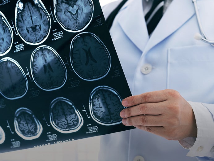 พบแพทย์เพื่อรักษาโรคสมองอักเสบจากภูมิคุ้มกัน anti-NMDAR