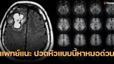 อาการปวดหัวที่ต้องพบแพทย์