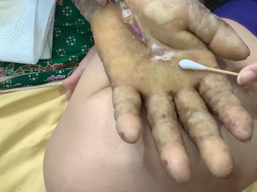 อาการเมฆ วินัย ไกรบุตร