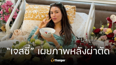 เจสซี่ เดอะเฟซ พ้นขีดอันตรายแล้ว เผยภาพหลังผ่าตัดกระดูกทับเส้นประสาท