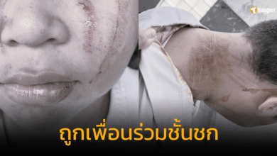 เด็กพิเศษถูกเพื่อนชกปาก