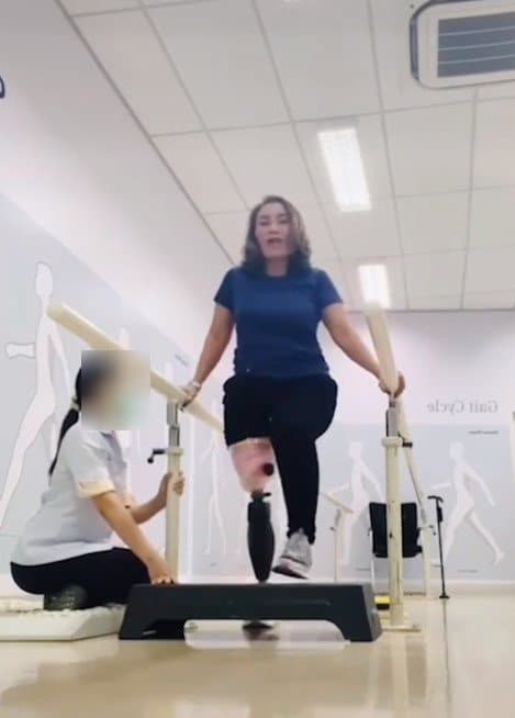 เปิดภาพ เหยื่อทางเลื่อนดอนเมือง ชีวิตกลับมาสดใส ฝึกเดิน-ว่ายน้ำด้วยขาเดียวได้แล้ว