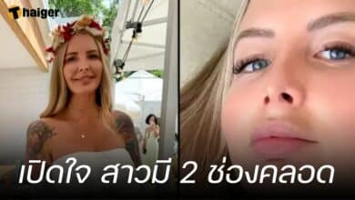 เปิดใจ สาวมี 2 ช่องคลอด