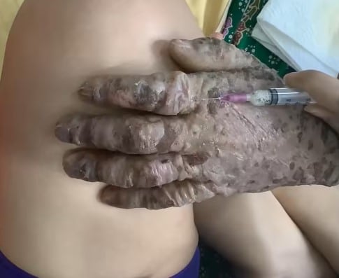 เมฆ วินัย ไกรบุตร ป่วยเป็นอะไร