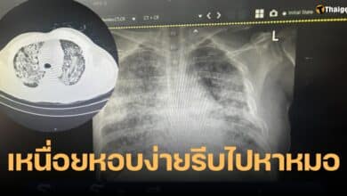 โปรตีนพอกปอด