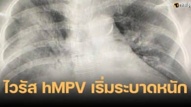ไวรัส hMPV