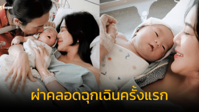 ก้อย รัชวิน เล่าประสบการณ์ผ่าคลอดฉุกเฉิน