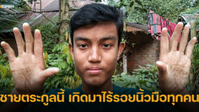 ตระกูลต้องสาป ผู้ชายทุกรุ่น เกิดมาไร้รอยนิ้วมือ โอด ใช้ชีวิตแสนลำบาก