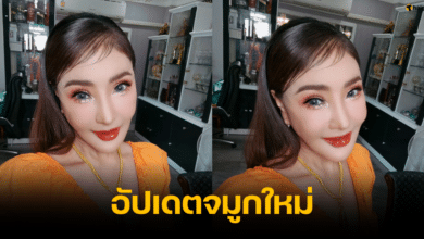ดาว มยุรี แก้จมูกใหม่ ผ่านไป 20 วัน