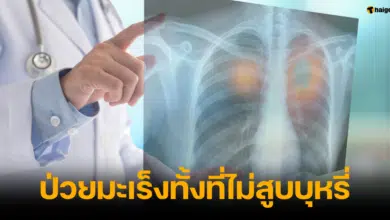 ผู้ป่วยมะเร็งปอด อายุ 27 ทั้งที่ไม่มีโรคประจำตัว ไม่สูบบุหรี่