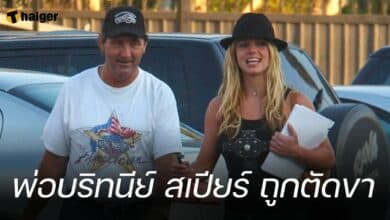 พ่อบริทนีย์ สเปียร์ ถูกตัดขา