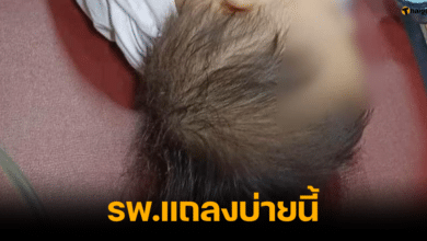 รพ.ที่เกิดเหตุจ่ายยาผิด แถลงบ่ายนี้