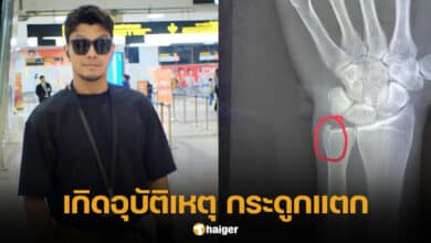 หนุ่ม กะลา ประสบอุบัติเหตุกระดูกแตก เอ็นอักเสบ