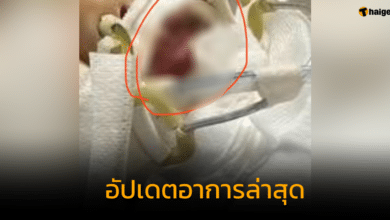 อัปเดตอาการล่าสุด เด็กได้รับยาผิด