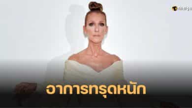 เซลีน ดิออน โรคคนแข็ง