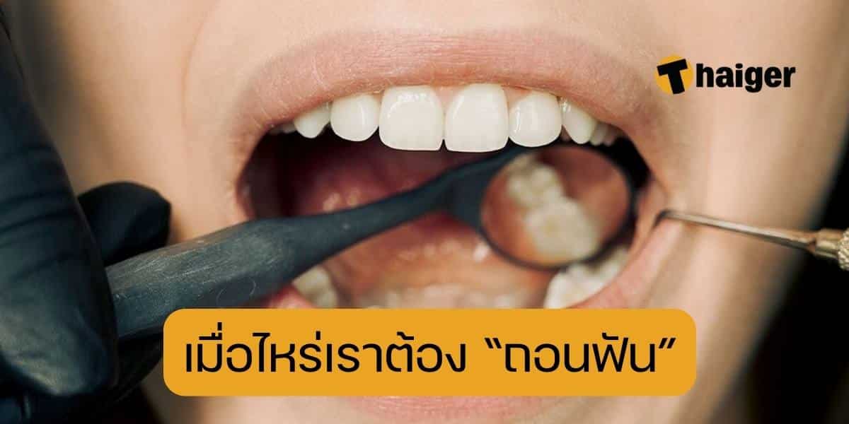 เมื่อไหร่เราต้องถอนฟัน