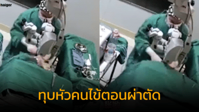 แพทย์จีน ทุบหัวคนไข้หญิง