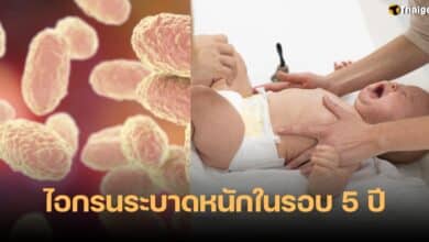 ไอกรนระบาดหนัก