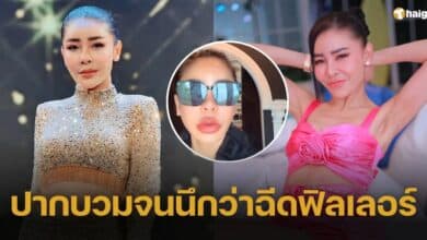 งงหนัก 'เป็กกี้ ศรีธัญญา' ตื่นมาปากบวมตุ่ย ไม่ต้องฉีดฟิลเลอร์