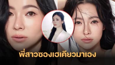 ดีเจต้นหอม ศัลยกรรมหน้าใหม่