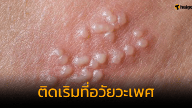 ติดเริมที่อวัยวะเพศจากคลินิก