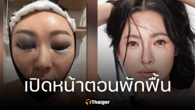 ต้นหอม ศกุลตลา เปิดหน้าใหม่ สวยเป็นคนละคน ช็อกกรีดจุดเดียวแต่ช้ำหนัก