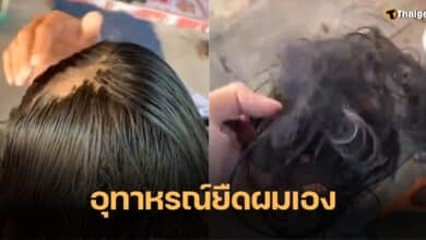 น้ำยายืดผม หัวล้าน