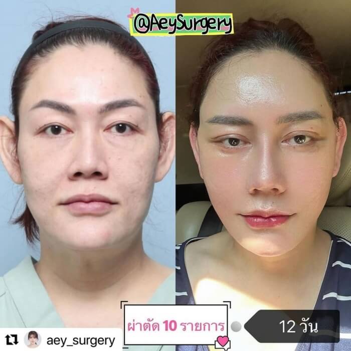 ภาพปัจจุบัน เกล้า น้ำพราว ผจก. ใหม่ ดาวิกา ศัลยกรรมสุดจึ้ง ดาราขยี้ตาทั้งวงการ